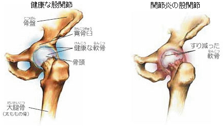 股関節