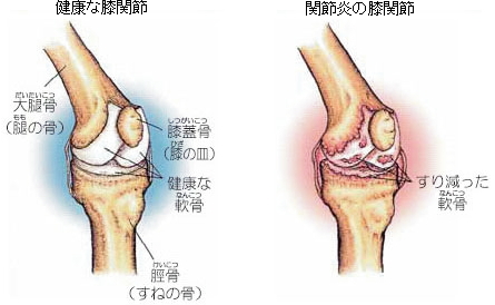 膝関節