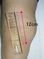術後3ヶ月の膝の写真