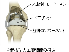 （術後3ヶ月・皮切12cm）